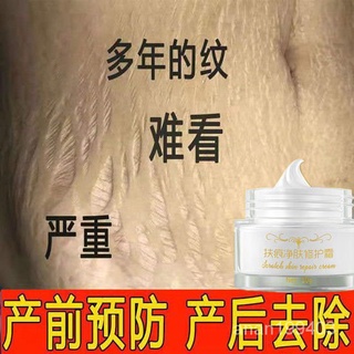 台灣熱賣去妊娠紋產後修護霜去除肥胖紋生長紋緊緻肚皮孕婦預防消除妊娠紋 rwk1